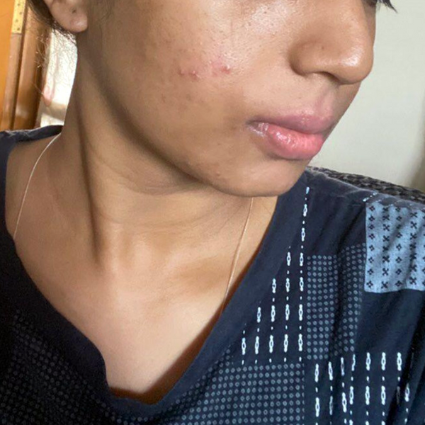 ab-1-after